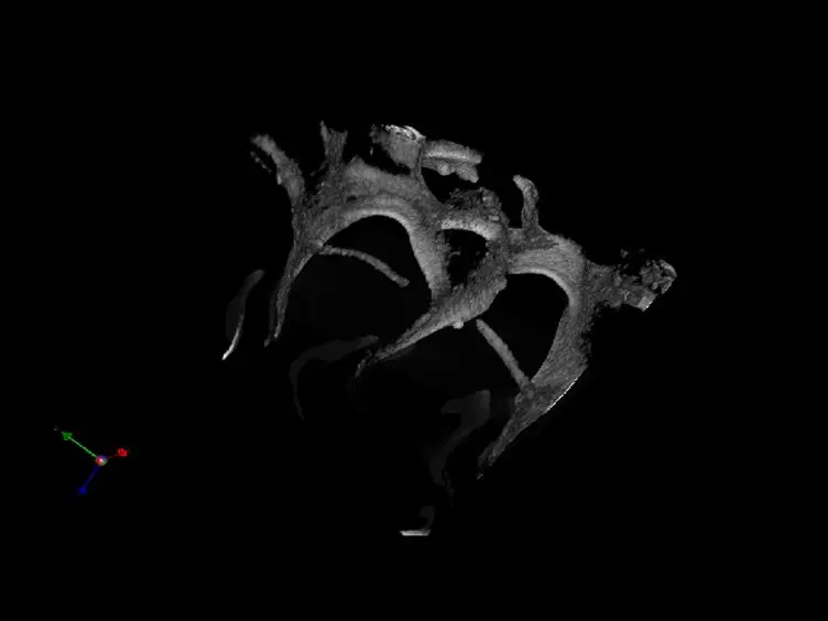 <em>Ex vivo</em> Mimicry of Normal and Abnormal Human Hematopoiesis