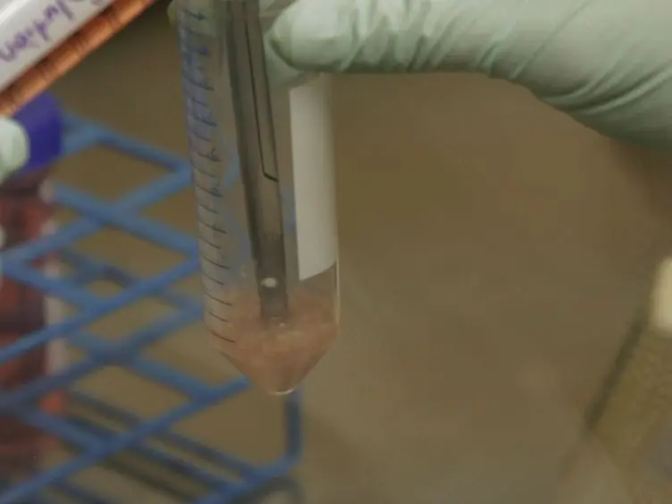 Isolation of Rat Portal Fibroblasts by <em>In situ</em> Liver Perfusion