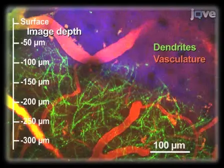 A Polished and Reinforced Thinned-skull Window for Long-term Imaging of the Mouse Brain