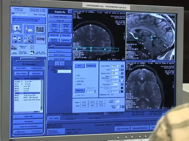 High-resolution Functional Magnetic Resonance Imaging Methods for Human Midbrain