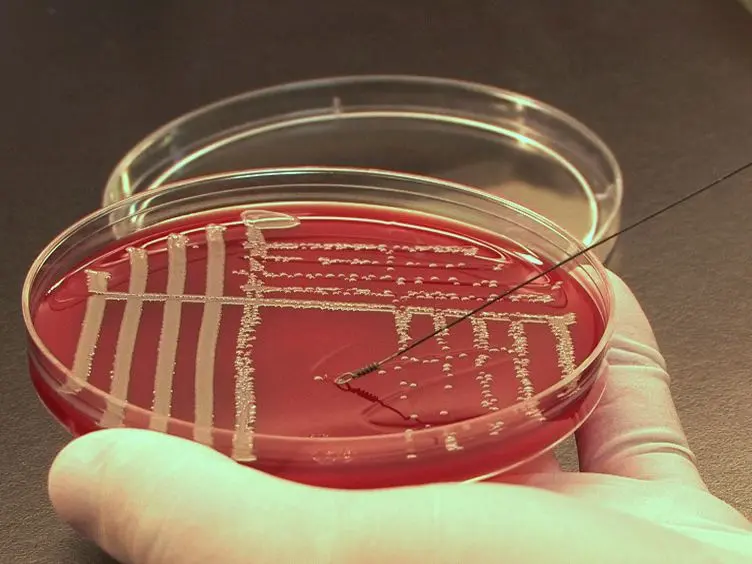 Experimental Endocarditis Model of Methicillin Resistant <em>Staphylococcus aureus</em> (MRSA) in Rat