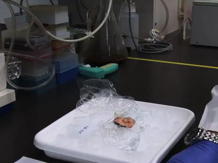 MicroRNA Detection in Prostate Tumors by Quantitative Real-time PCR (qPCR)