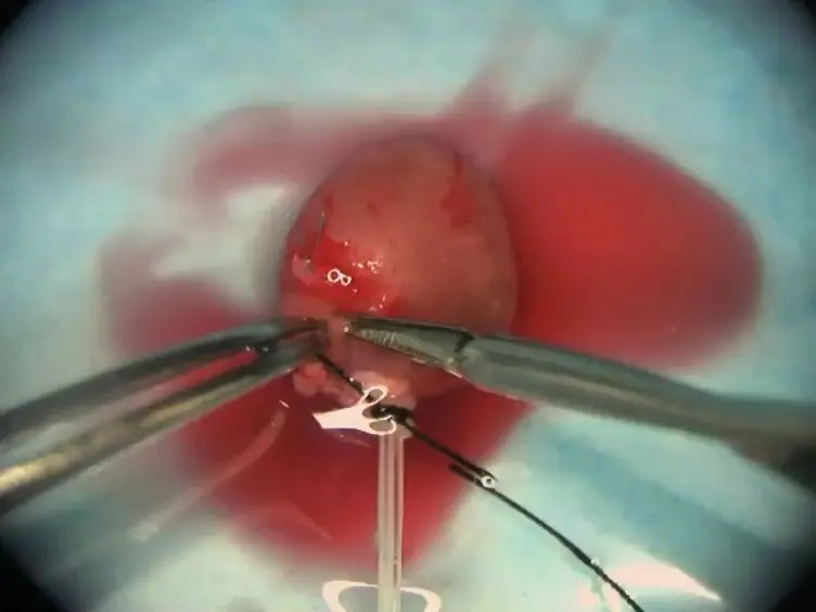 A Murine Closed-chest Model of Myocardial Ischemia and Reperfusion