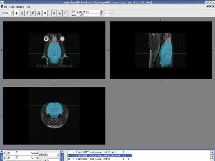 The Use of Pharmacological-challenge fMRI in Pre-clinical Research: Application to the 5-HT System