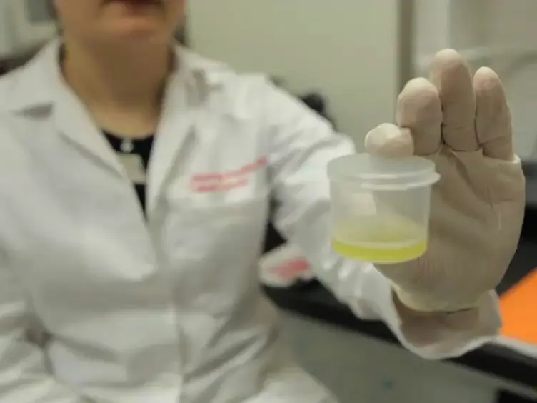 The &alpha;-test: Rapid Cell-free CD4 Enumeration Using Whole Saliva