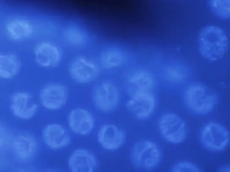 Basic <em>Caenorhabditis elegans</em> Methods: Synchronization and Observation