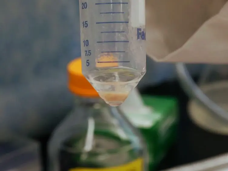 Mouse Islet of Langerhans Isolation using a Combination of Purified Collagenase and Neutral Protease