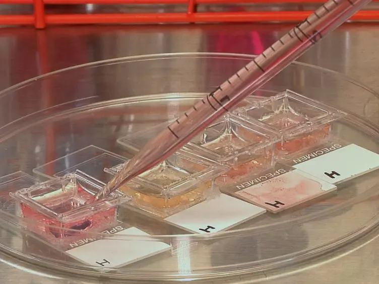 Fabrication and Use of MicroEnvironment microArrays (MEArrays)