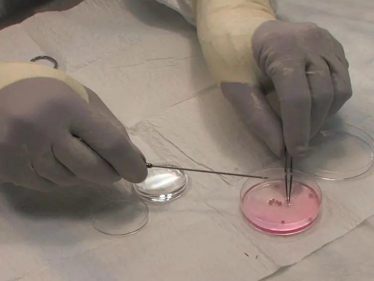 Using the BLT Humanized Mouse as a Stem Cell based Gene Therapy Tumor Model