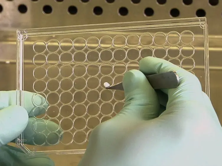 Repair of a Critical-sized Calvarial Defect Model Using Adipose-derived Stromal Cells Harvested from Lipoaspirate