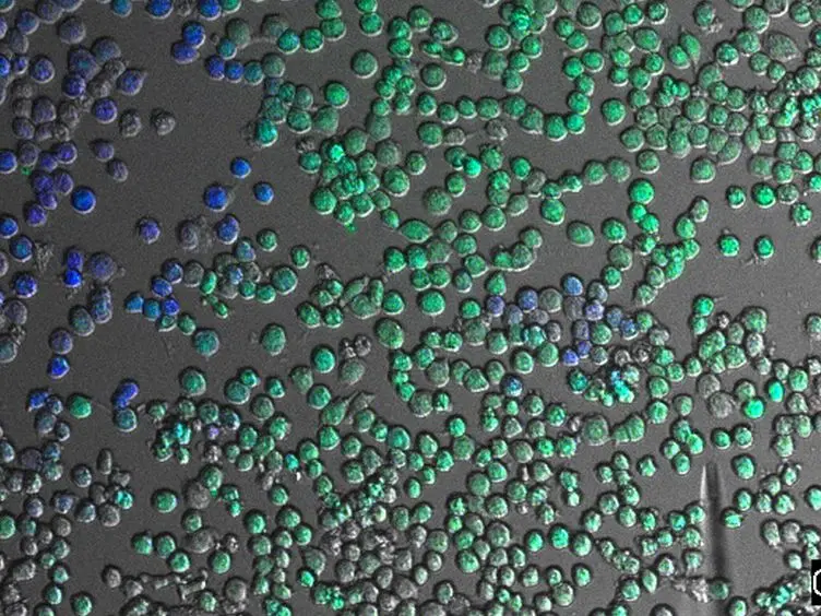 Visualization of Bacterial Toxin Induced Responses Using Live Cell Fluorescence Microscopy