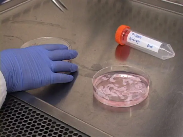 Mechanical Stimulation of Chondrocyte-agarose Hydrogels