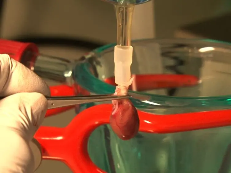 Measurement of Antibody Effects on Cellular Function of Isolated Cardiomyocytes