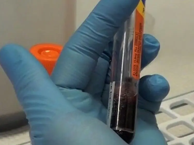 A Practical and Novel Method to Extract Genomic DNA from Blood Collection Kits for Plasma Protein Preservation