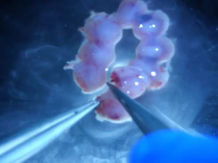 An Explant Assay for Assessing Cellular Behavior of the Cranial Mesenchyme