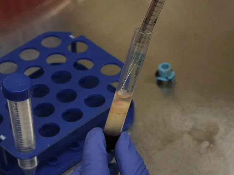 Generation of Human Induced Pluripotent Stem Cells from Peripheral Blood Using the STEMCCA Lentiviral Vector
