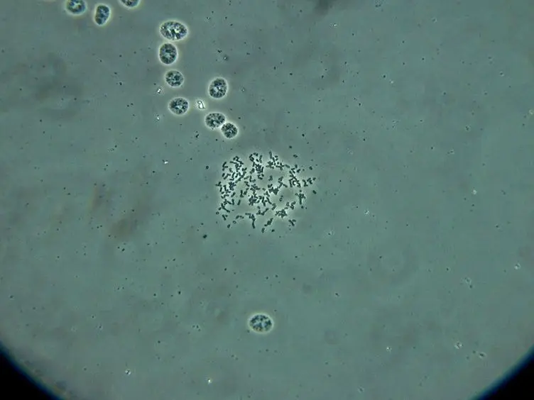 Chromosome Replicating Timing Combined with Fluorescent <em>In situ</em> Hybridization