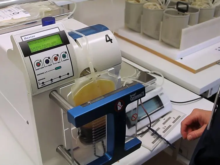 Preparation and Pathogen Inactivation of Double Dose Buffy Coat Platelet Products using the INTERCEPT Blood System
