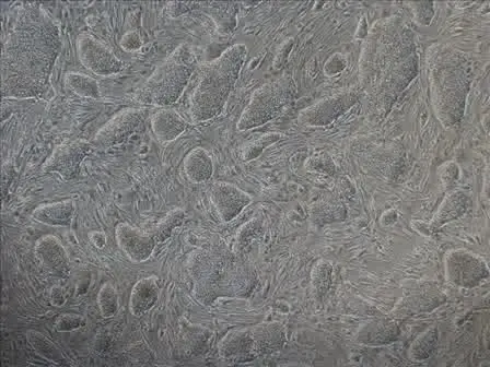 Freezing Human ES Cells