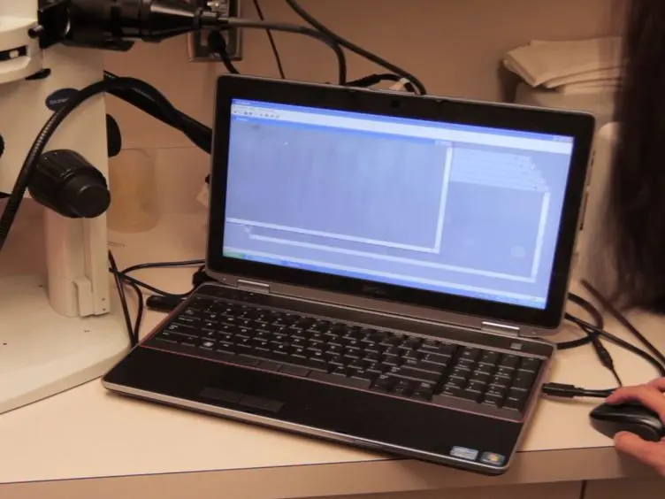 Non-invasive Assessment of Microvascular and Endothelial Function