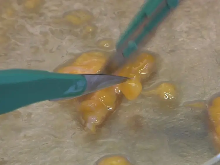 Processing of Human Reduction Mammoplasty and Mastectomy Tissues for Cell Culture