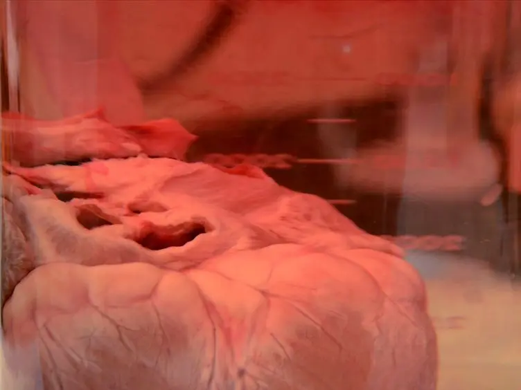 Procedure for Decellularization of Porcine Heart by Retrograde Coronary Perfusion