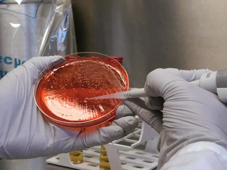 Single Cell Measurements of Vacuolar Rupture Caused by Intracellular Pathogens