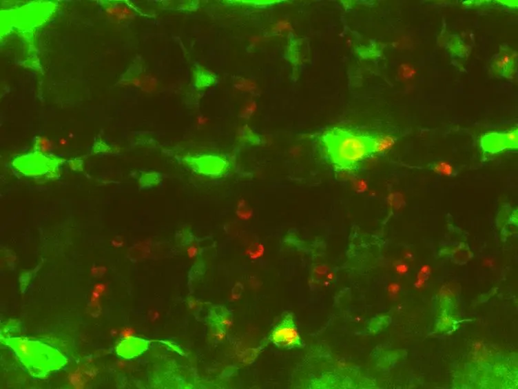 Live Imaging of Apoptotic Cell Clearance during <em>Drosophila </em>Embryogenesis
