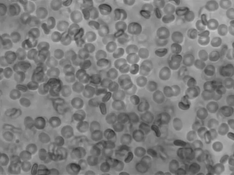 <em>Ex Vivo</em> Red Blood Cell Hemolysis Assay for the Evaluation of pH-responsive Endosomolytic Agents for Cytosolic Delivery of Biomacromolecular Drugs