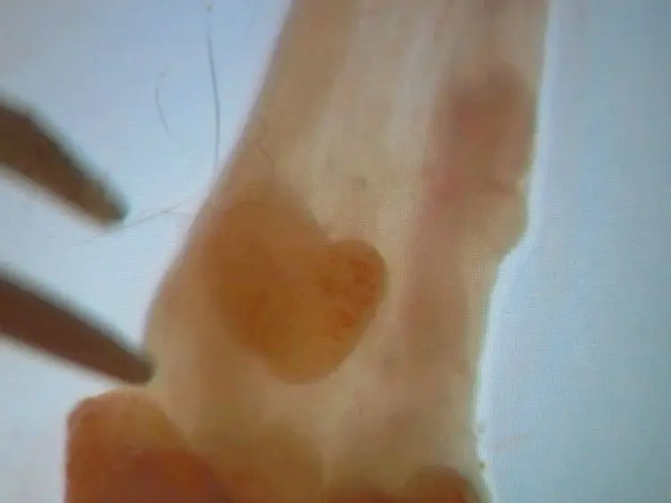 <em>In vitro</em> Organoid Culture of Primary Mouse Colon Tumors