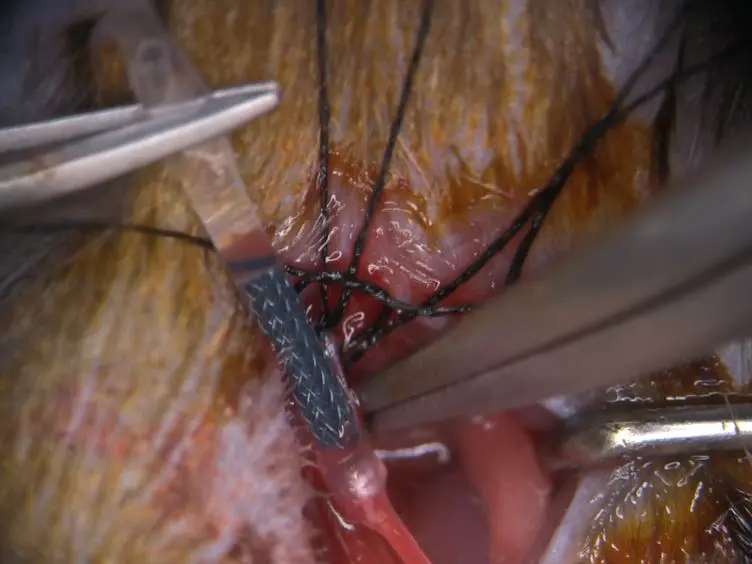 A Murine Model of Stent Implantation in the Carotid Artery for the Study of Restenosis