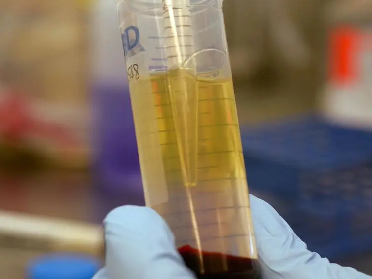 New Tools to Expand Regulatory T Cells from HIV-1-infected Individuals