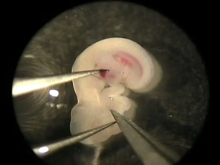Separation of Mouse Embryonic Facial Ectoderm and Mesenchyme