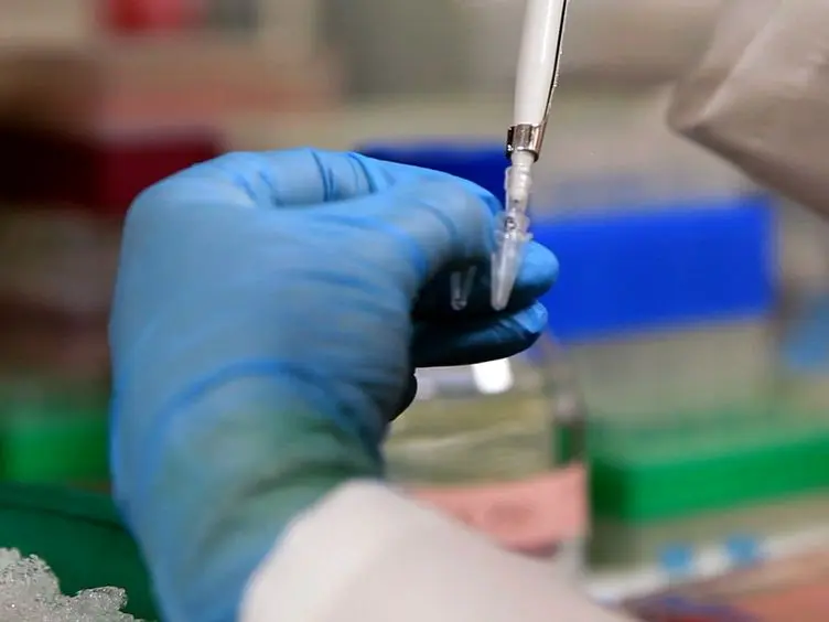 Purification and microRNA Profiling of Exosomes Derived from Blood and Culture Media