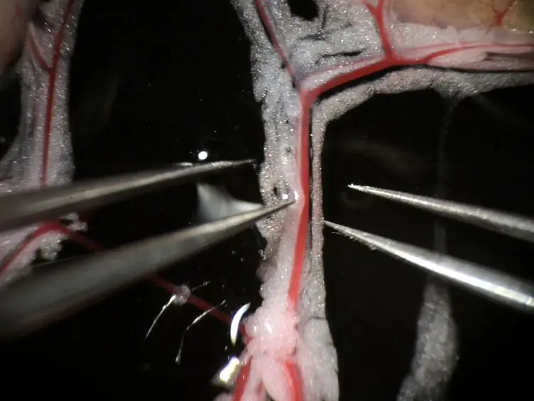 Assessing Murine Resistance Artery Function Using Pressure Myography