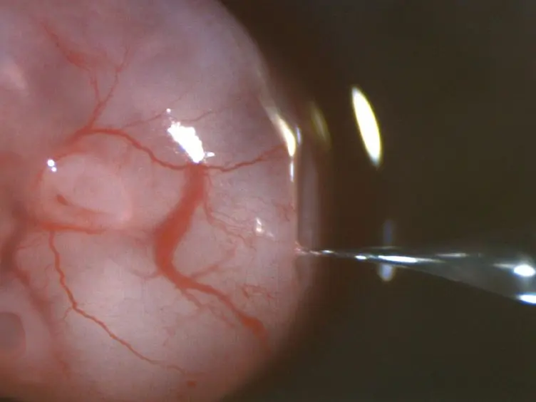 Isolation of Cerebrospinal Fluid from Rodent Embryos for use with Dissected Cerebral Cortical Explants