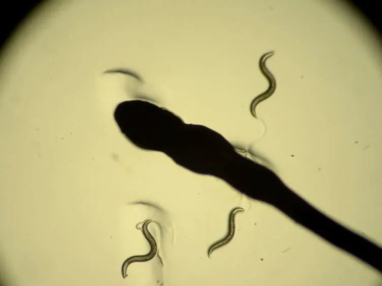 <em>In vivo</em> Neuronal Calcium Imaging in <em>C. elegans</em>