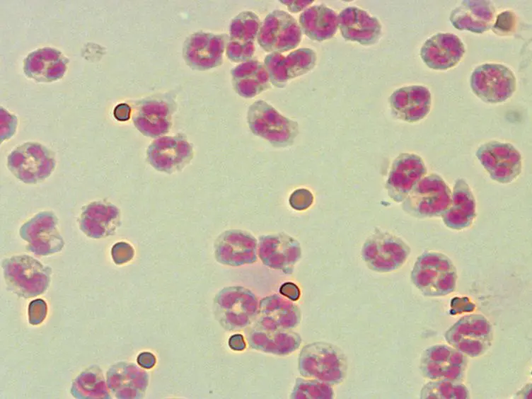 A Simple and Efficient Method to Detect Nuclear Factor Activation in Human Neutrophils by Flow Cytometry