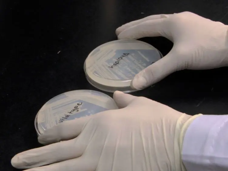 Coupled Assays for Monitoring Protein Refolding in <em>Saccharomyces cerevisiae</em>
