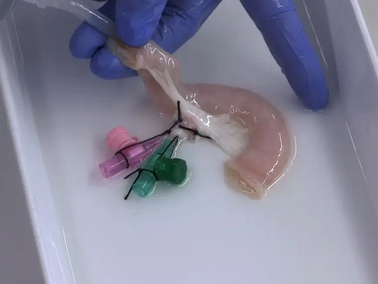 Tissue Engineering of a Human 3D <em>in vitro</em> Tumor Test System
