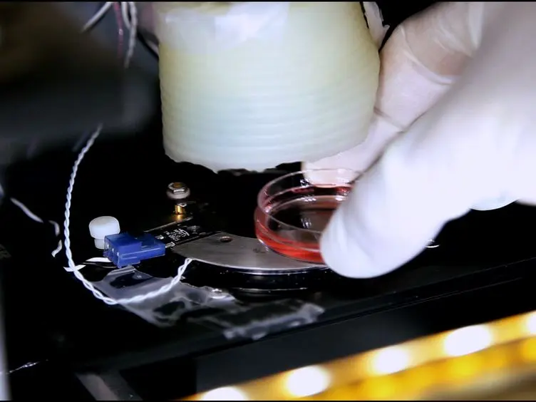 Measurement of Tension Release During Laser Induced Axon Lesion to Evaluate Axonal Adhesion to the Substrate at Piconewton and Millisecond Resolution