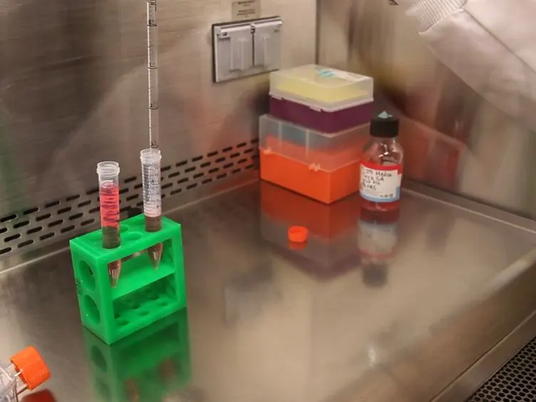 Induction and Analysis of Epithelial to Mesenchymal Transition