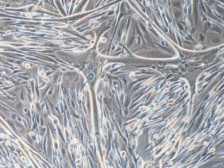Transplantation of Induced Pluripotent Stem Cell-derived Mesoangioblast-like Myogenic Progenitors in Mouse Models of Muscle Regeneration