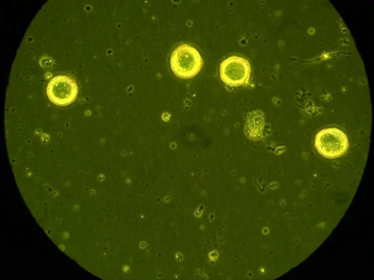 Isolation of Sensory Neurons of <em>Aplysia californica</em> for Patch Clamp Recordings of Glutamatergic Currents