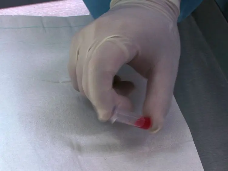 Parabiosis in Mice: A Detailed Protocol