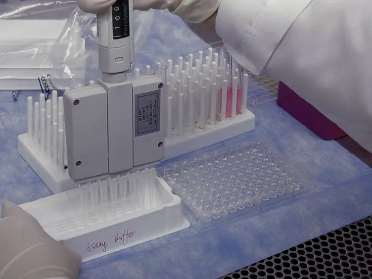 Generation of a Novel Dendritic-cell Vaccine Using Melanoma and Squamous Cancer Stem Cells