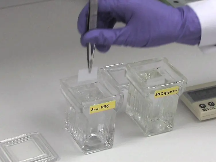 Robust 3D DNA FISH Using Directly Labeled Probes