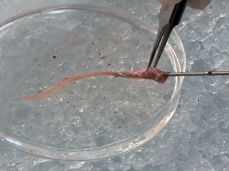 Isolation of Primary Myofibroblasts from Mouse and Human Colon Tissue
