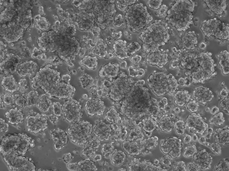 Isolation, Culture, and Imaging of Human Fetal Pancreatic Cell Clusters