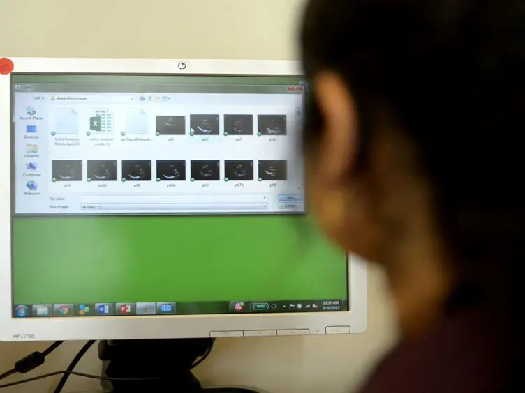 Ultrasonic Assessment of Myocardial Microstructure